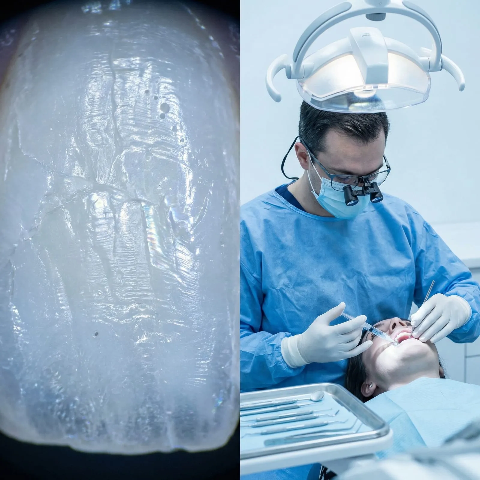A close-up of tooth enamel beside a clinician treating a patient under a dental light.
